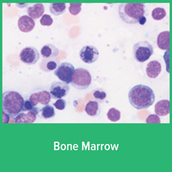 eLearn LAB Modules - Bone Marrow